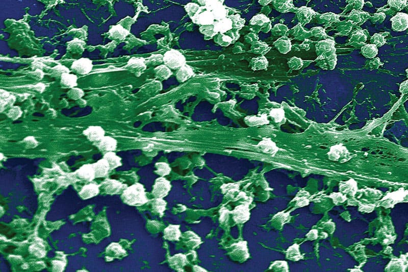 Staphylococcus-aureus-bacteria